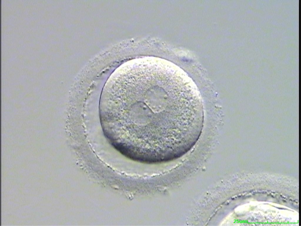 Day 1 Embryo
