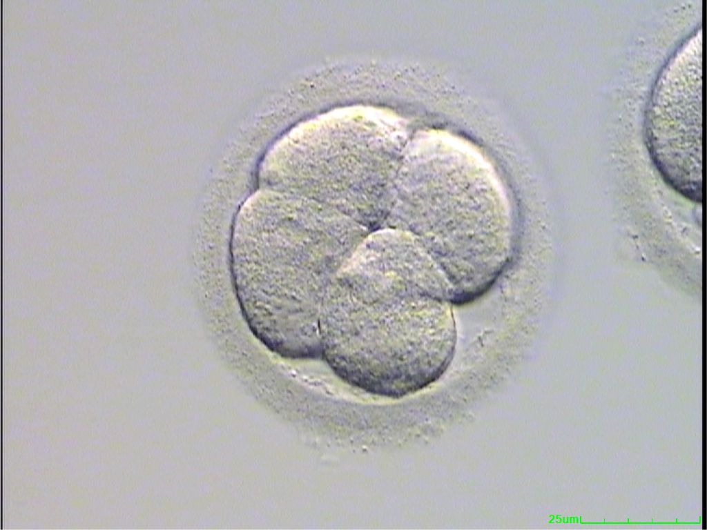 Day 2 Embryo