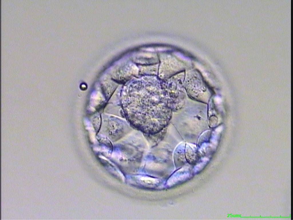 Day 5 Embryo