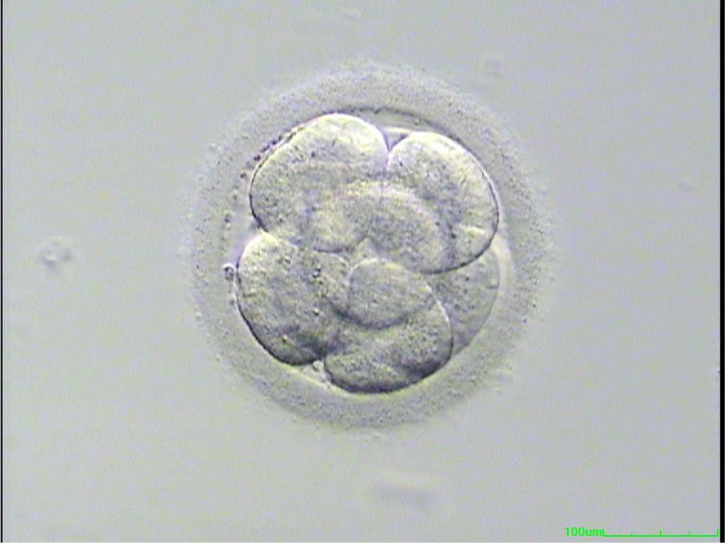 Day 3 Embryo