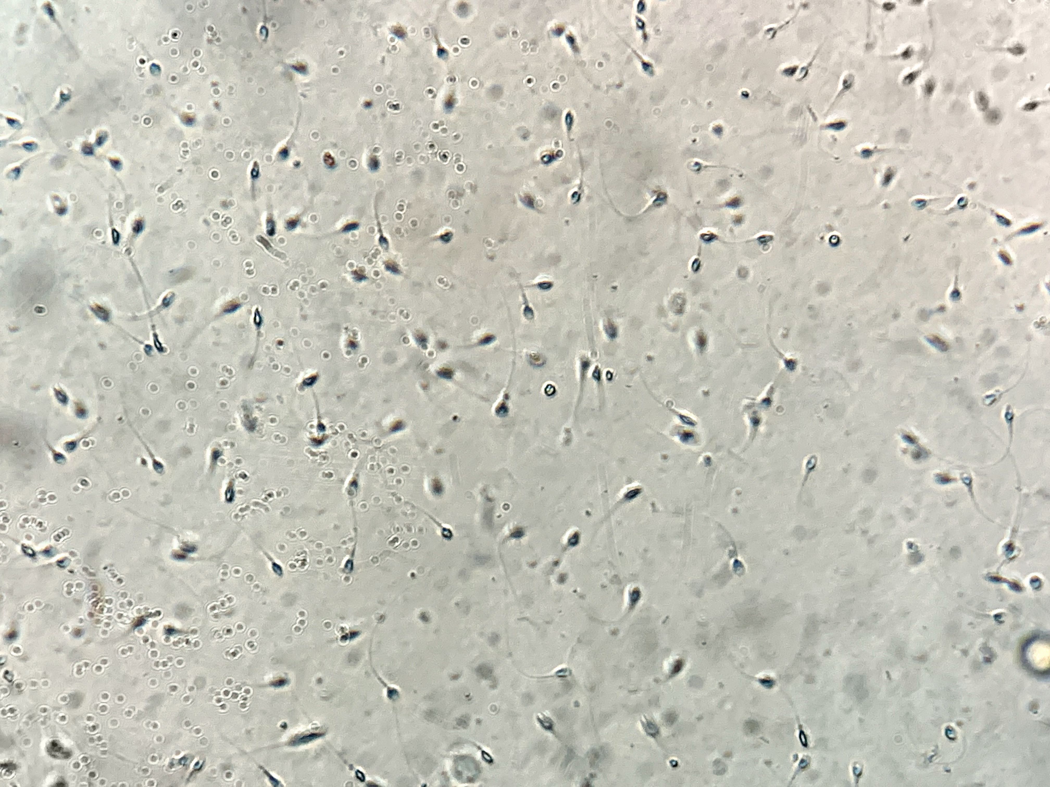 Sperm under microscope